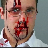 Hombre mirando de frente con la cara sangrando 