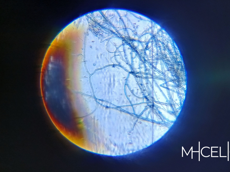 Vista del mhicelio desde un microscopio.