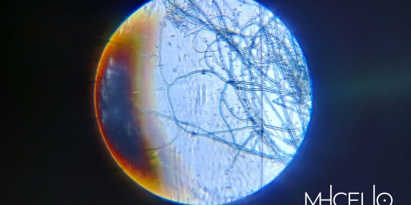 Vista del mhicelio desde un microscopio.